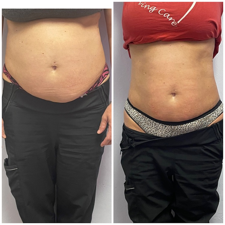 67B69646-4A87-4172-9015-E30E4758000D-1